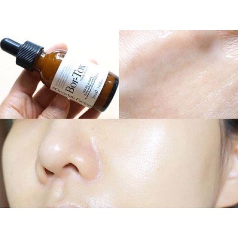 TINH CHẤT CĂNG DA CHỐNG LÃO HOÁ BOR-TOX MEDIPEEL 30ml 777062