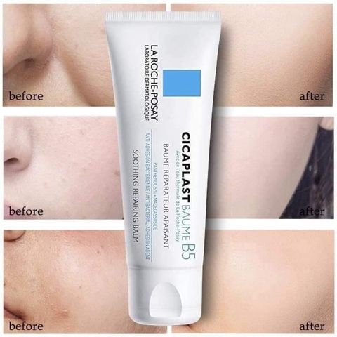 Kem Dưỡng La Roche Posay Phục Hồi và Làm Dịu Da Cicaplast Baume B5 40ml