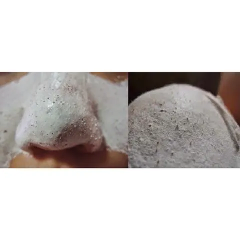 Combo 2 hộp Gel lột mụn PEELING PACK