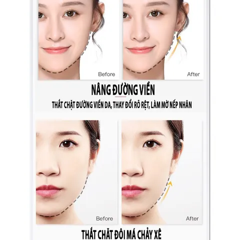 Mặt nạ thon gọn mặt nâng cơ vline