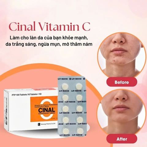 Viên Uống Trắng Da Cinal C 100 Viên Nhật Nội Địa - Hỗ Trợ Sáng Da, Giảm Mụn, Bổ Sung Vitamin C Chính Hãng