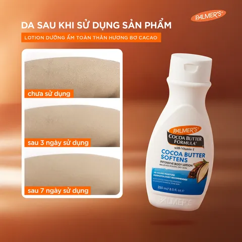 Sữa dưỡng thể dưỡng ẩm (bơ cacao + vitamin E) - Palmer's Cocoa Butter Formula Daily Skin Therapy Intensive Body Lotion 50ml