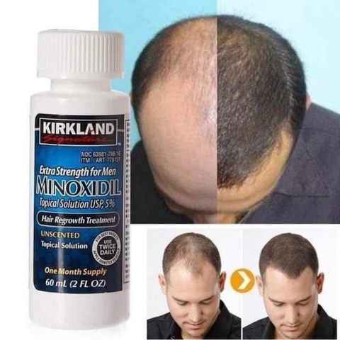 Dung Dịch Mọc Râu Và Tóc Hiệu Quả Của Mỹ Minoxidil 5% Kirk-land 6x60ml 778678