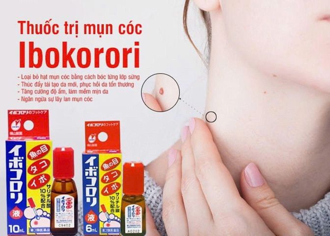 Dung Dịch Bôi Mụn Cóc Ibokorori, hoạt động theo cơ chế làm mềm và làm bong tróc từ từ lớp sừng cứng của mụn cóc, mụn cơm, hoặc vết chai sần, giúp đẩy chân mụn lên bề mặt da tự nhiên