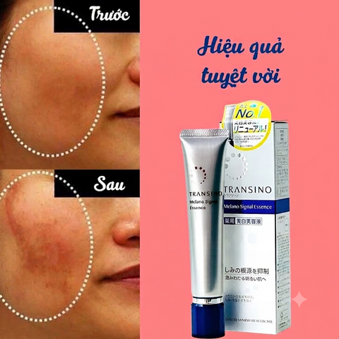 Tinh Chất Kem Nám Transino Whitening Essence 50G Nhật Bản – Hỗ Trợ Làm Mờ Đốm Nâu, Dưỡng Sáng Da