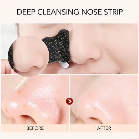 HOT Combo 10 Miếng dán mũi lột mụn đầu đen rửa sạch sâu lỗ chân lông 788134