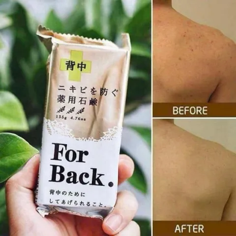 Xà phòng For Back tẩy da chết giảm mụn lưng 135g 788397