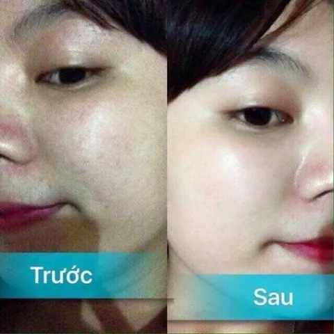 Kem dưỡng da Nhật bản giảm thâm, nám trắng da 788555