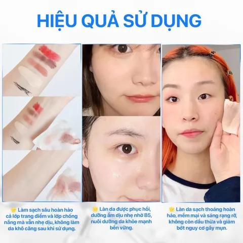 Nước Tẩy Trang Cho Bà Bầu B5 GUO - Micellar Cleansing Water Cấp Ẩm, Làm Dịu Da Nhạy Cảm, Sạch Sâu 75ml/200ml