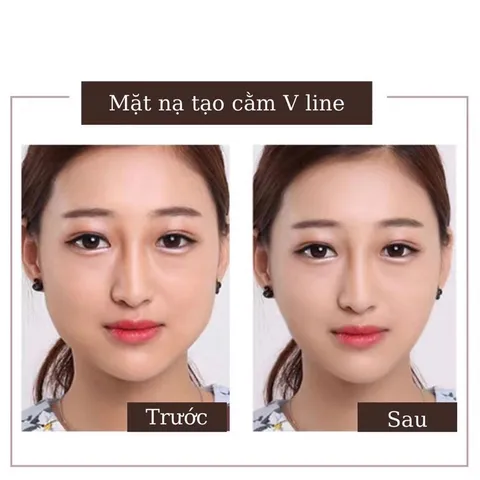 Combo 10 Mặt nạ định hình cằm V-line, tạo mặt Vline, Mặt Nạ Nâng Cơ, giảm mỡ nọng cằm (mặt nạ xài 1 lần) 792772