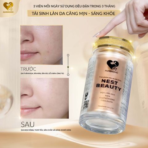 COMBO [2 HỘP] VIÊN UỐNG YẾN SÀO NEST BEAUTY HỖ TRỢ NGĂN NGỪA LÃO HÓA - YẾN SÀO 9.000MG, NMN 16.200MG 794152