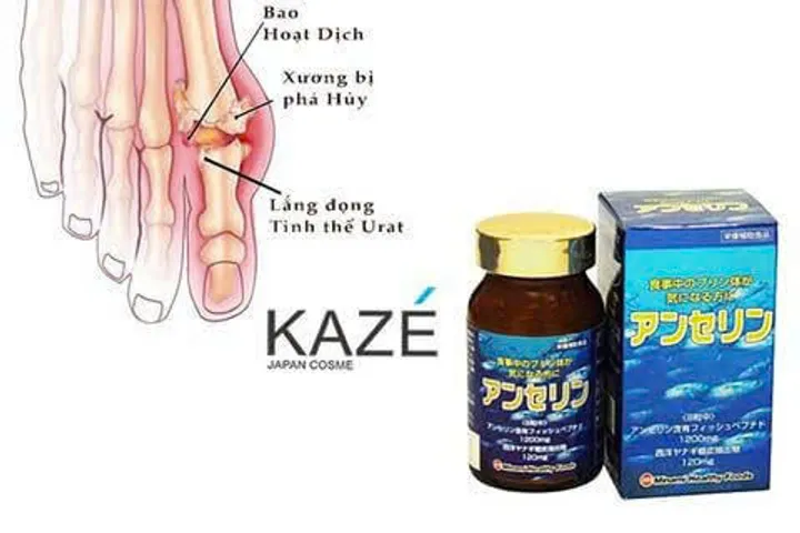Viên Uống Giảm GÚT Anserine Minami 240 Viên – Hỗ Trợ Duy Trì Acid Uric Ổn Định, Chăm Sóc Sức Khỏe Xương Khớp