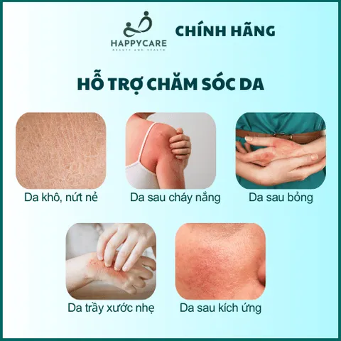 Xịt Bỏng Panthenol Nano Bạc 130g Chính Hãng, Làm Dịu Da Sau Bỏng, Cháy Nắng, Dưỡng Ẩm Phục Hồi Da