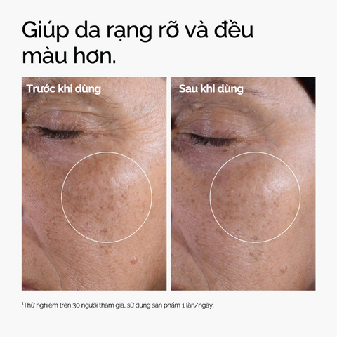 Nước Hoa Hồng The Ordinary Glycolic Acid 7% 240ml – Toner AHA Tẩy Tế Bào Chết, Làm Sáng Và Mịn Da