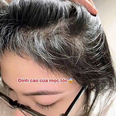 (HÀNG CHÍNH HÃNG MỸ) VIÊN UỐNG BIOTIN NATROL 10,000MCG – ĐẸP DA, KHỎE TÓC & MÓNG 100 viên