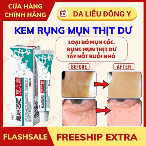 Kem Rụng Mụn Thịt Dư Keyou 796678