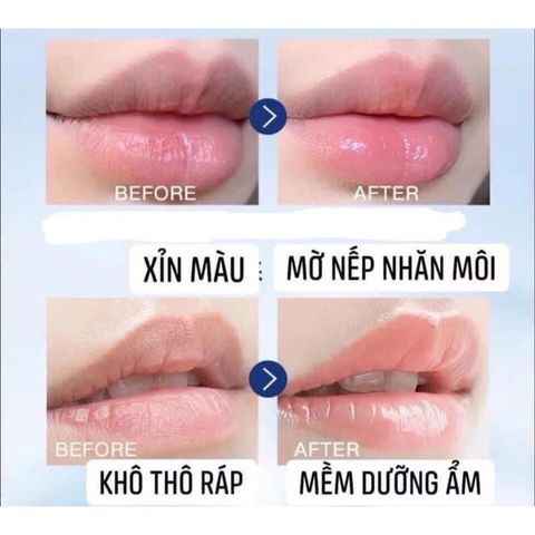 Dưỡng môi Vaseline Lip Therapy chứa Dulcis Oil - Dầu hạnh nhân - giúp giữ ẩm cho môi, chống nứt nẻ 796804
