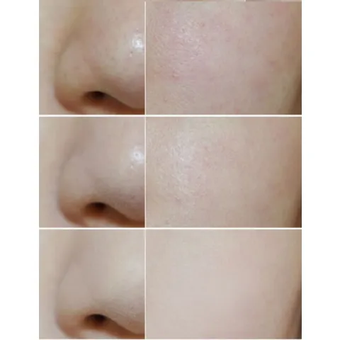 Phấn phủ Shiseido Baby Powder Pressed 796807