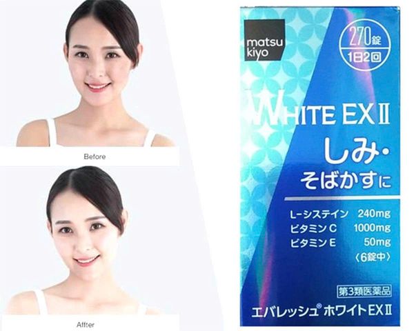 Viên Uống Trắng Da WHITE EX II Mờ Thâm Nám Bật Tông Hiệu Qủa 270 Viên Nhật Bản 797136