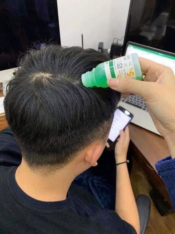 TINH CHẤT BÔI KÍCH THÍCH MỌC TÓC JG 30ML Nhật Bản
