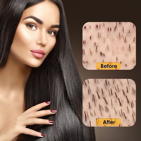 Chai xịt dưỡng kích mọc tóc hỗ trợ tóc mọc dài nhiều và dày, mọc tóc nhanh, bóng, mượt, ngăn rụng tóc - Mã 1102