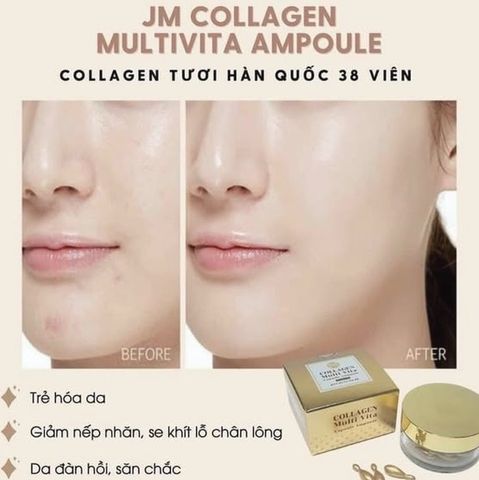 Tinh Chất Jm Collagen Multi Vita Capsule Ampoule - hộp ⭐ Viên