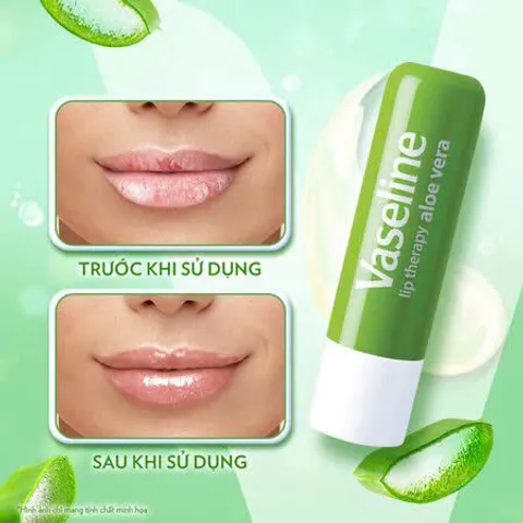 [ DATE 05.2026 ] Son Dưỡng Môi Dạng Thỏi Vaseline Lip Therapy 4.8g HƯƠNG LÔ HỘI