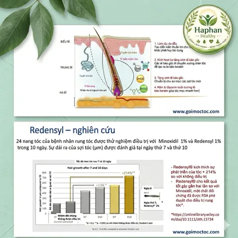Redenlyl Lotion - Xịt dưỡng tóc , chống rụng tóc, kích thích mọc tóc