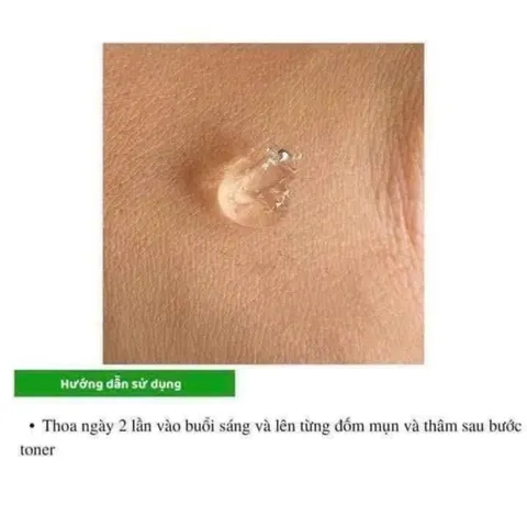 Kem Giảm Mụn Ẩn Và Thâm Gamma Megaduo Plus Gel 15gr