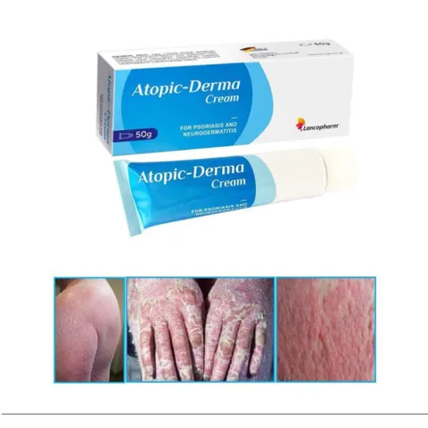 ATOPIC DERMA CREAM  - GIẢI PHÁP TỐI ƯU CHO NGƯỜI BỊ VẢY NẾN, Á SỪNG, VIÊM DA