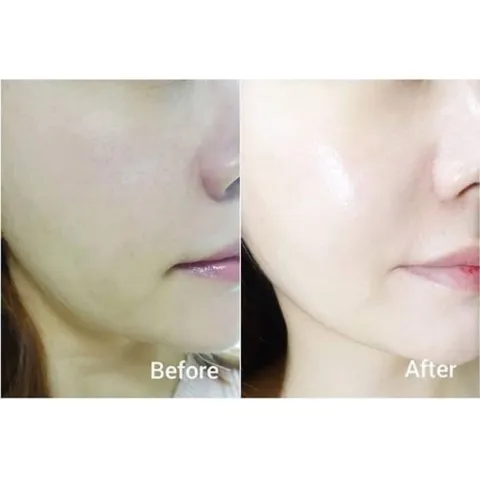 Kem dưỡng trắng, căng bóng ngày đêm Forencos 50ml