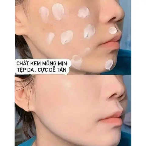 Kem Dưỡng da Forencos Hàn Quốc dưỡng ngày