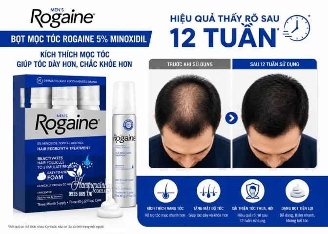 (HÀNG CHÍNH HÃNG MỸ) KEM MỌC TÓC DẠNG BỌT DÀNH CHO NAM MEN'S ROGAINE EXTRA STRENGTH 60ml