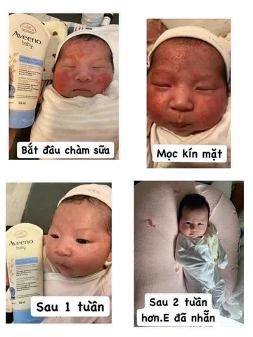 (HÀNG CHÍNH HÃNG MỸ) KEM BÔI CHÀM AVEENO BABY ACZEMA THERAPY 206g