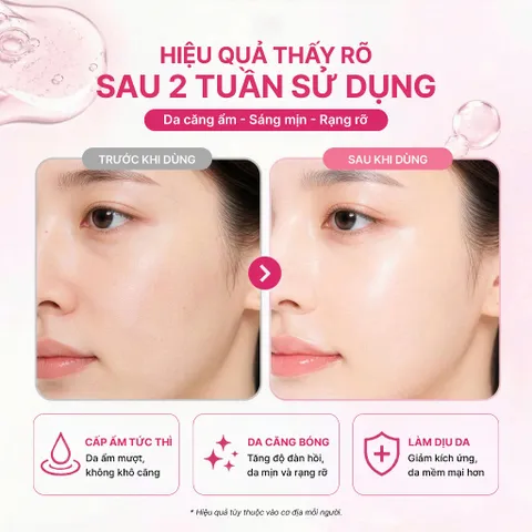 Mặt Nạ Thạch IMU Deep Collagen Jelly Pack Cấp Ẩm, Phục Hồi, Dưỡng Sáng, Ngừa Lão Hóa Mờ Nhăn 34g