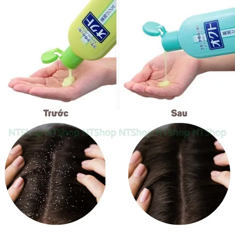 Dầu gội đầu Giảm Gàu, Mọc Tóc Lion Nhật Bản - Sach Gàu, Tóc Khỏe, Không Khô Cứng, Mùi Hương Dễ Chịu