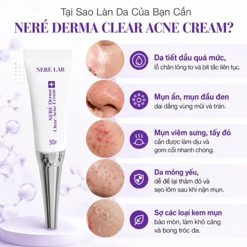 Bộ dưỡng da NERÉ Serum, Kem dưỡng, Kem mụn, Chăm sóc da mụn toàn diện, Cấp ẩm, Phục hồi da, Hỗ trợ giảm mụn