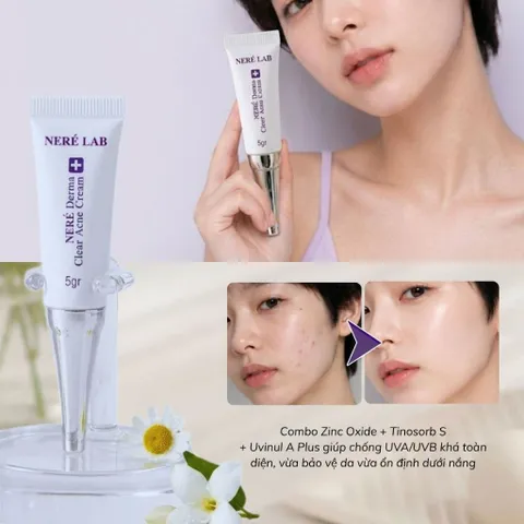 Bộ dưỡng da NERÉ Serum, Kem mụn, Kem chống nắng SPF50+ PA+++, Chăm sóc da mụn, Hỗ trợ giảm mụn, Bảo vệ da