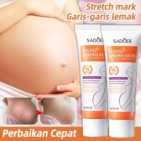 1 tuýt Kem Chống Rạn Da 40g làm mờ vết rạn dưỡng ẩm sáng da đều màu chăm sóc da săn chắc Chính Hãng