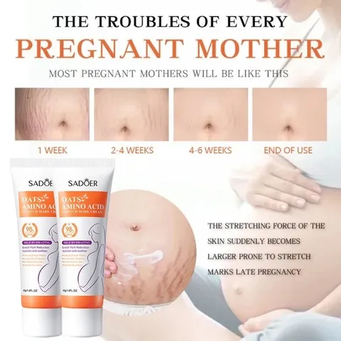 1 tuýt Kem Chống Rạn Da 40g làm mờ vết rạn dưỡng ẩm sáng da đều màu chăm sóc da săn chắc Chính Hãng