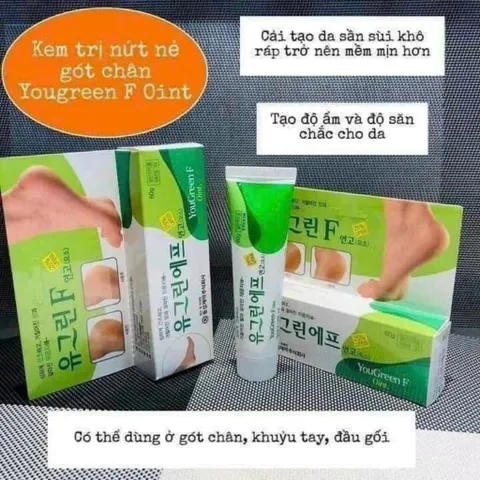 Kem nứt gót chân Hàn Quốc mềm mại da hiệu quả chất lượng