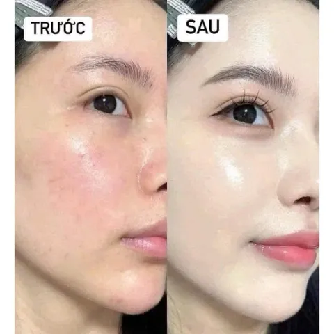 Phấn Nước cao cấp siêu mịn The Luminous Lifting Cushion Foundation Broad Spectrum SPF 20 Tone 01 Kèm lõi thay thế 807494