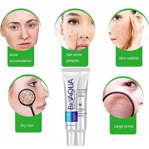 Kem hỗ trợ mụn thâm BioAqua 30ml 807546