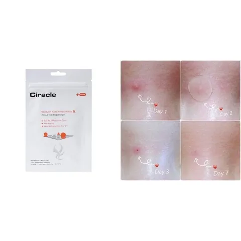 24 miếng] Miếng Dán Mụn Giúp Làm Dịu Và Hút Dịch Mủ Ciracle Red Spot Acne Pimple Patch 807580