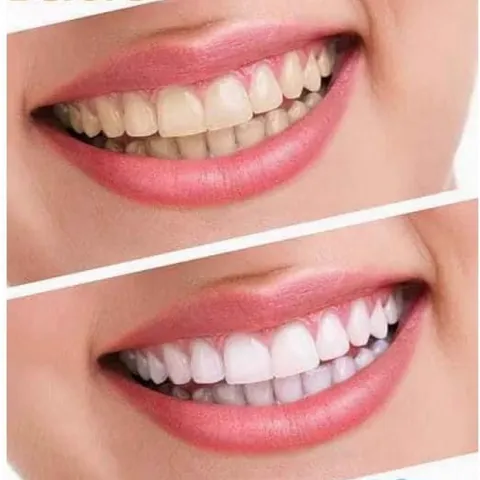( MẪU MỚI 147GR )  KEM ĐÁNH RĂNG CREST 3D WHITE ADVANCED TRIPLE WHITENING   NỘI ĐỊA MỸ 808468