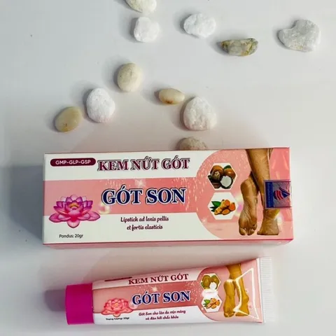 Kem nứt gót GÓT SON (Tuýp 20g) Giúp giữ ẩm, làm tăng độ đàn hồi cho da, giúp tái tạo tế bào da chân.