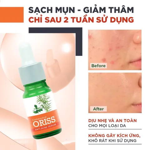 Serum Mụn Oriss Hỗ Trợ Ngừa Mụn Phục Hồi Da Mờ Thâm Thu Nhỏ Lỗ Chân Lông Chai 10ml