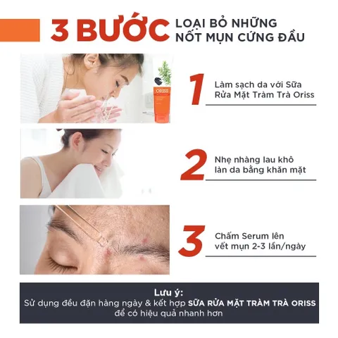 Serum Mụn Oriss Hỗ Trợ Ngừa Mụn Phục Hồi Da Mờ Thâm Thu Nhỏ Lỗ Chân Lông Chai 10ml