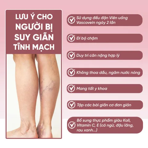 Viên Uống Hỗ Trợ Cải Thiện Bệnh Suy Giãn Tĩnh Mạch Vascovein Hộp 30 viên