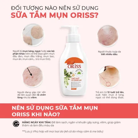 Sữa Tắm Hỗ Trợ Làm Loại Bỏ Mụn Cơ Thể Oriss Chiết Xuất Tràm Trà Lá Chanh Lim Sạch Sâu Và Làm Sáng Da Chai 300ml